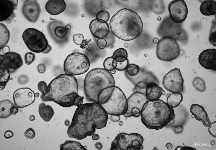 
Organoidai: mokslo naujovė, keičianti ligų tyrimus, diagnostiką ir gydymą                