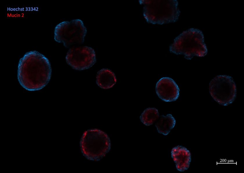 
Organoidai: mokslo naujovė, keičianti ligų tyrimus, diagnostiką ir gydymą                