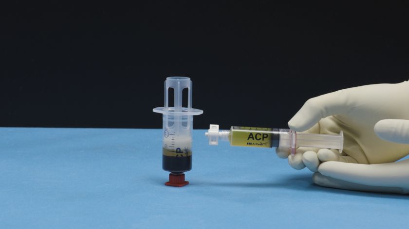 
Gydytojas paneigia mitus apie trombocitais praturtintos plazmos injekcijas į sąnarius                