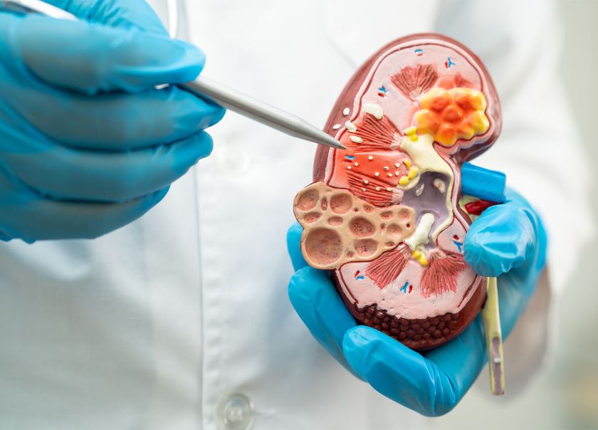 Artėjant pasaulinei inkstų dienai gydytojas nefrologas pataria, kaip laiku atpažinti ir sustabdyti inkstų ligas